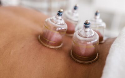 Know more about Cupping