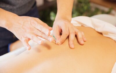 Get Ready to Experience Acupuncture